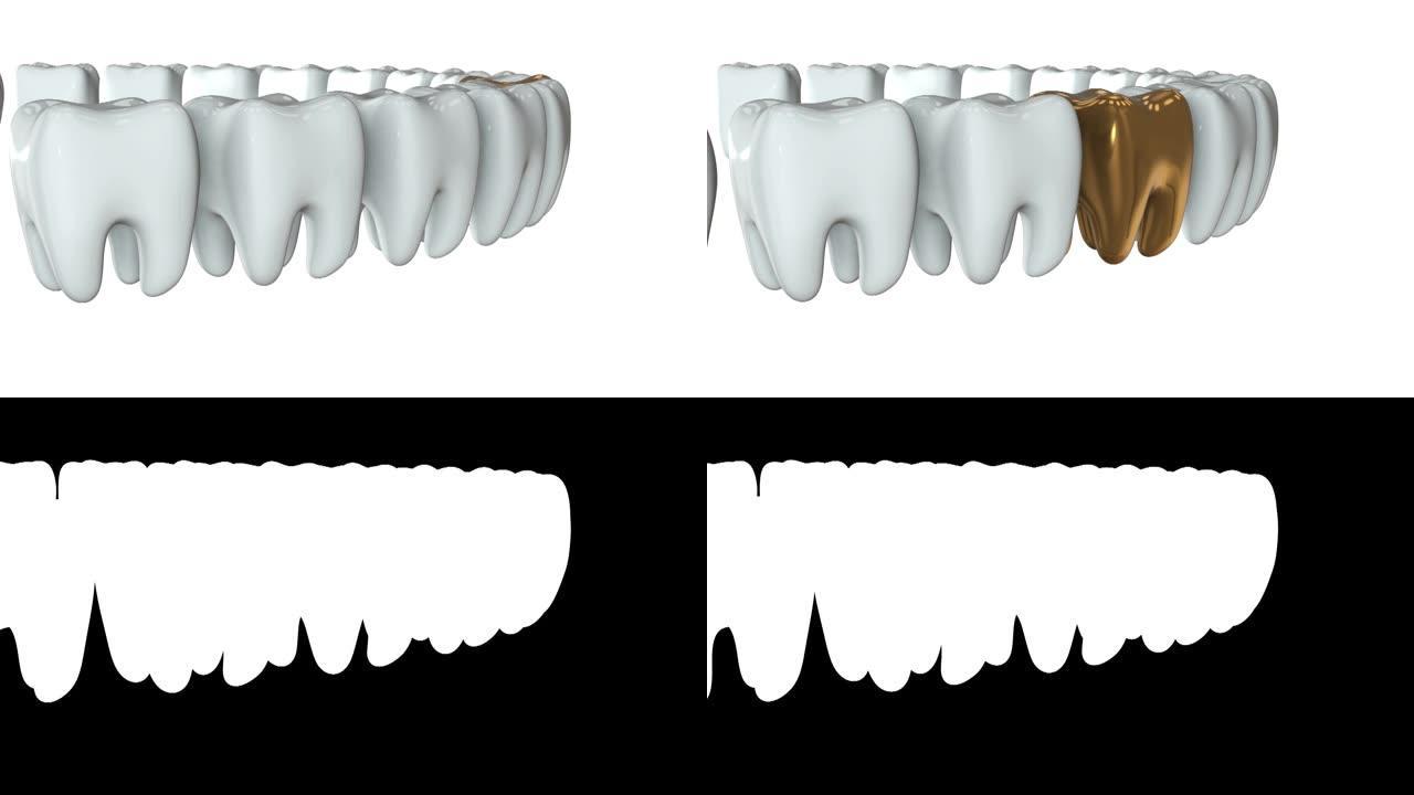 一排白色牙齿中的金色牙齿。3D渲染。牙科，出众，经营理念。