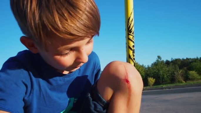 一名少年骑着踏板车后膝盖骨折。保持好心情