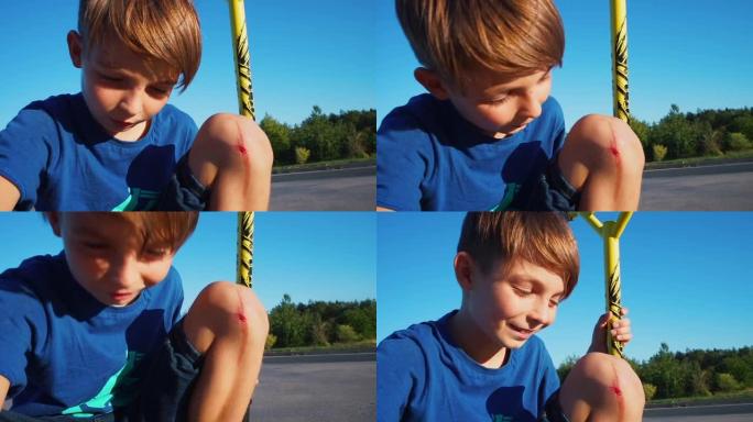 一名少年骑着踏板车后膝盖骨折。保持好心情