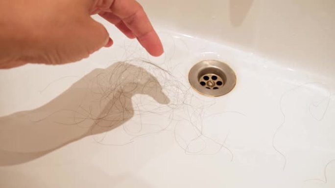 一只手在洗碗中收集深色长的女性掉落的头发，洗刷头发后脱发，雄激素性脱发