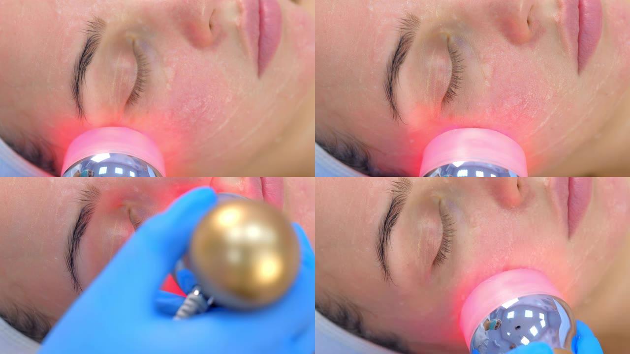 透明质酸凝胶在语音电泳面部程序上的女性肖像。