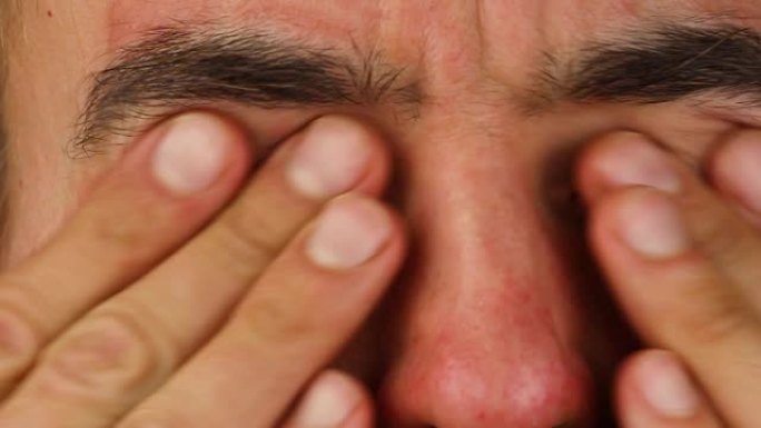 人类抓伤两只眼睛有红色过敏反应，面部皮肤红肿和脱皮牛皮癣，季节性皮肤病学问题，特写