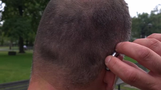 一名40岁的聋人纠正了他耳朵里的助听器