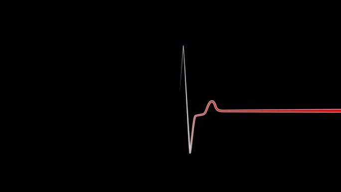心电图监测仪红线心电图心率心脏死亡生命体