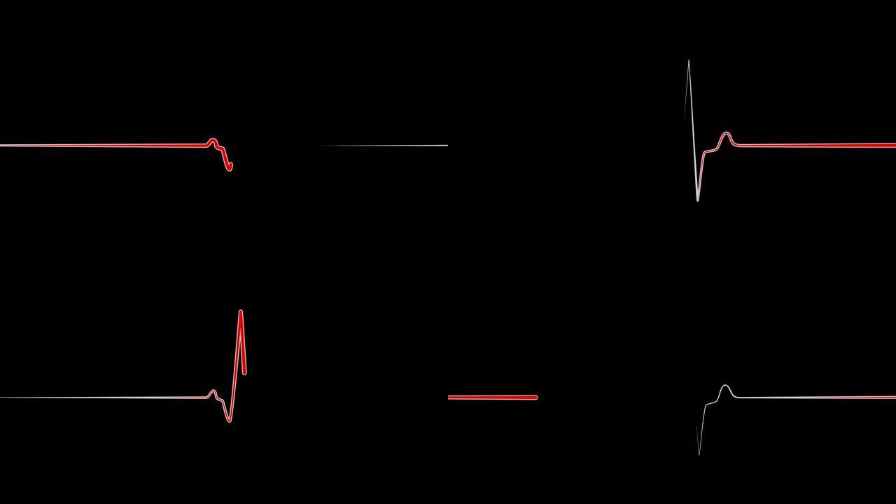 心电图监测仪红线心电图心率心脏死亡生命体