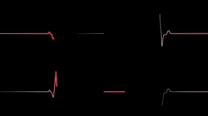 心电图监测仪红线心电图心率心脏死亡生命体
