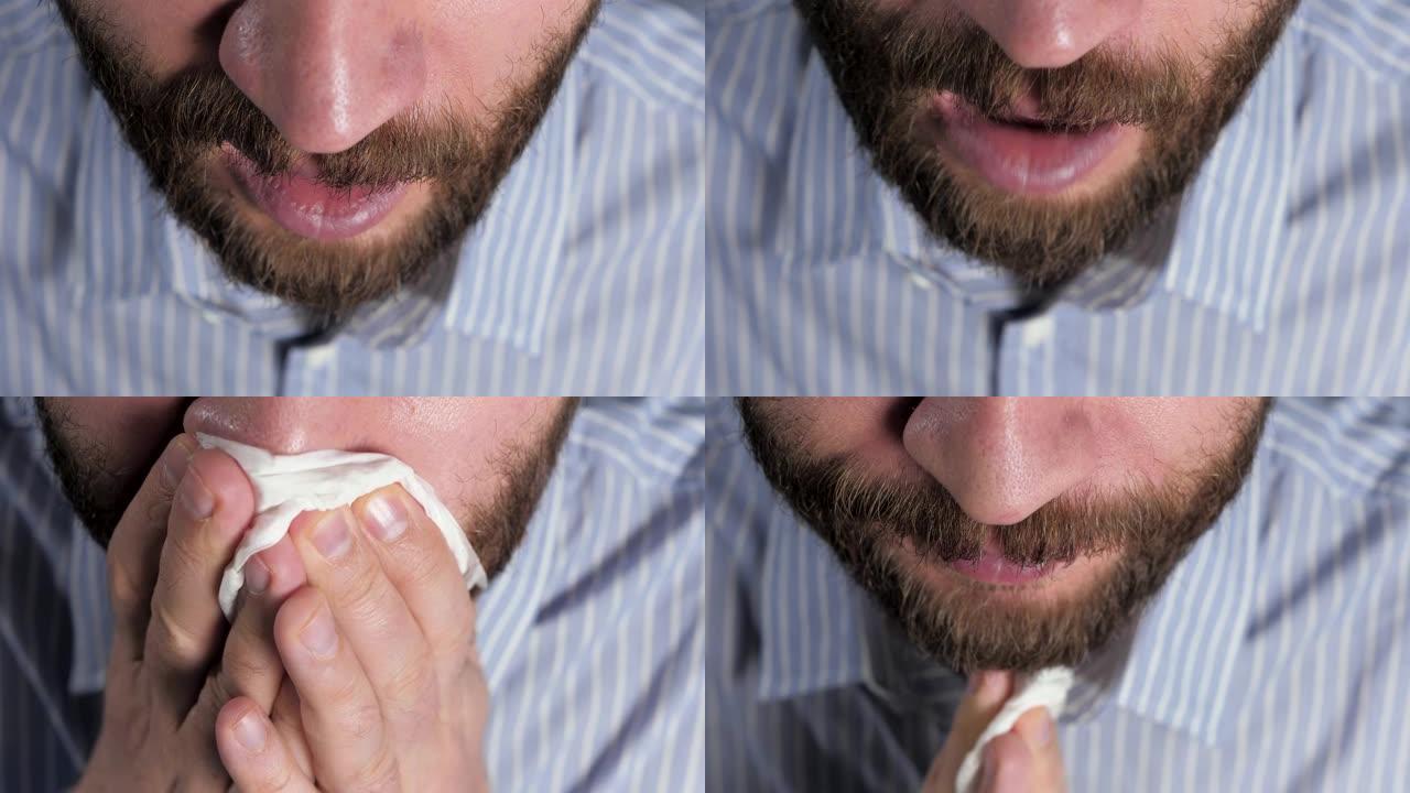 男人打喷嚏，用纸巾闭上嘴。过敏，猫毛，灰尘，感冒，流感，鼻炎概念。顶视图。特写