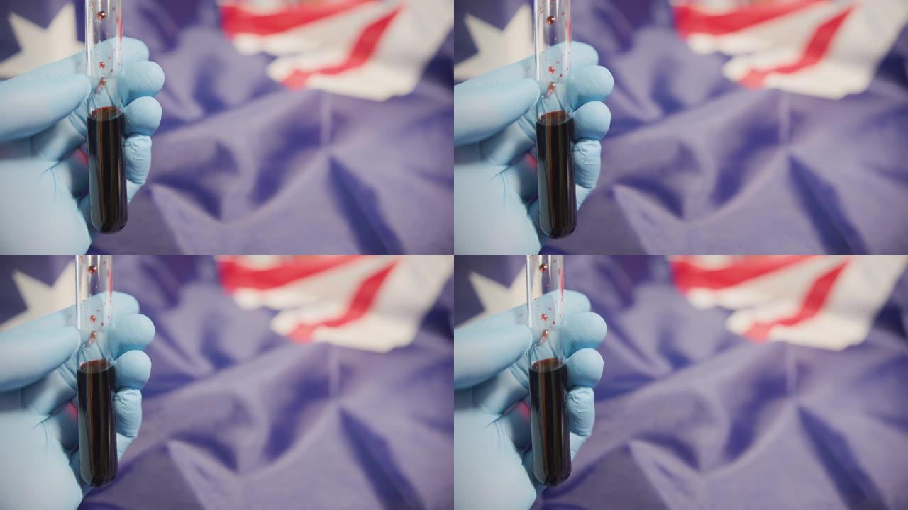 实验室医生戴着手套的手拿着一小瓶血液进行测试。背景中的澳大利亚国旗。复制空间。