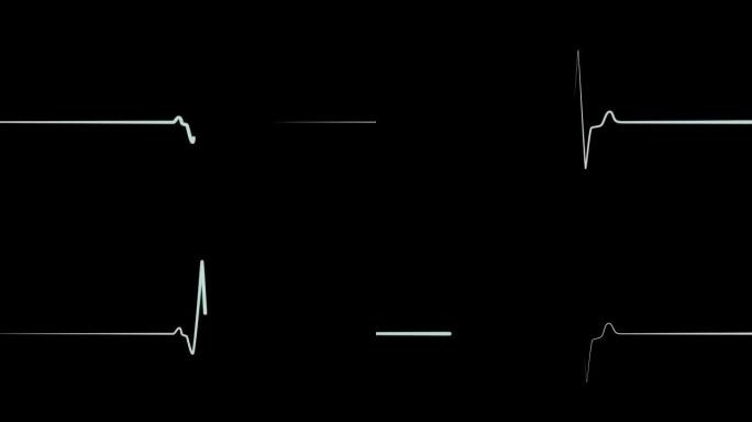 医疗屏幕上的青色flatline EKG或ECG flatline