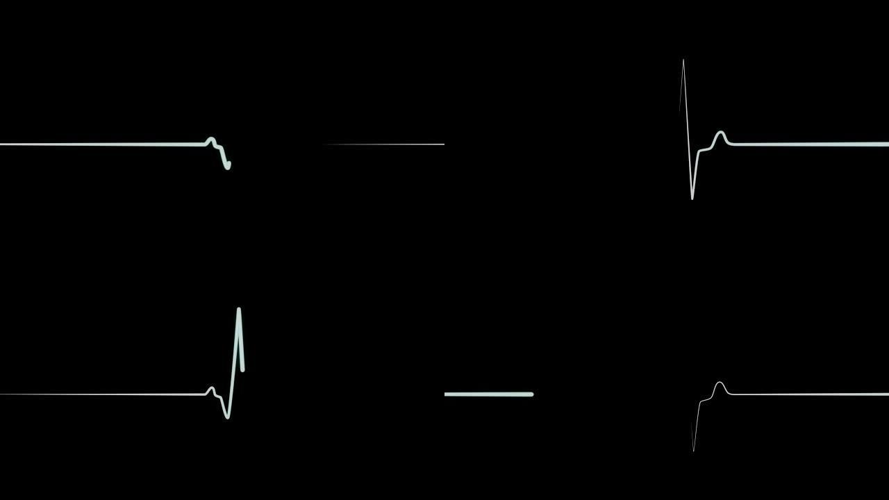 医疗屏幕上的青色flatline EKG或ECG flatline