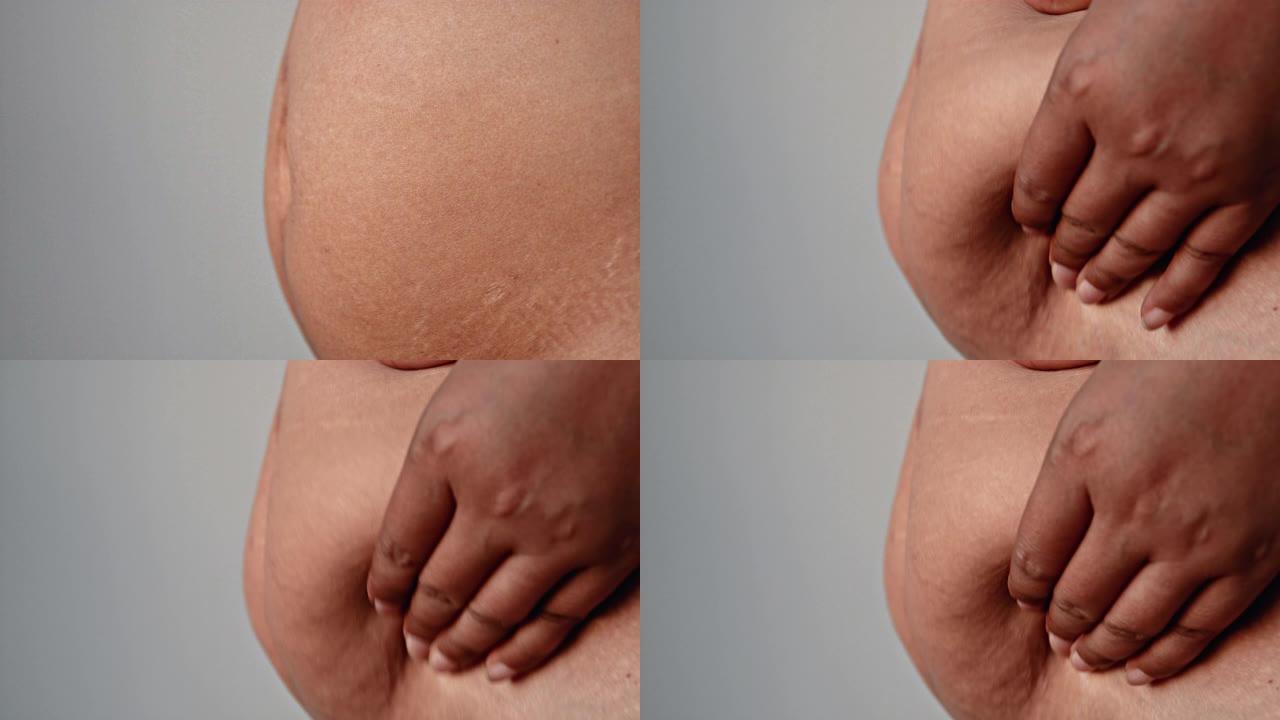 肥胖的腹部肥胖妇女的特写视频，健康状况不佳的概念