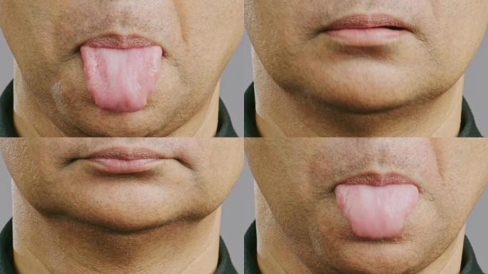 关闭高年级男子的嘴，伸出舌头进行检查。亚洲人，微距镜头。