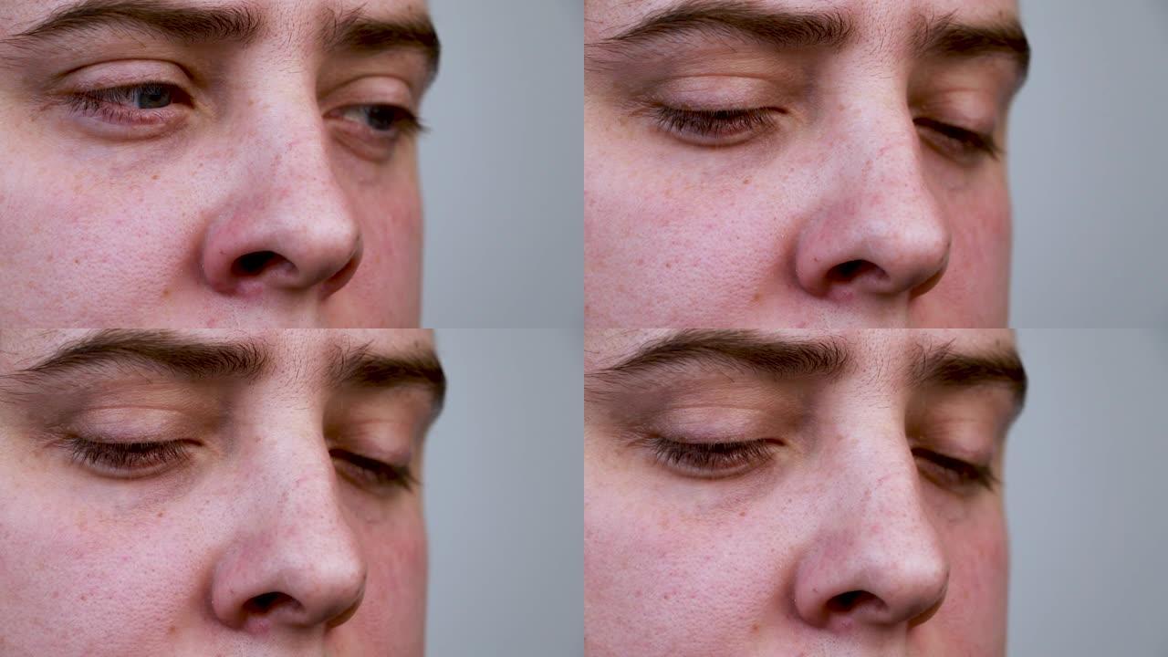 一个男人鼻子的特写。黑点和粗大的毛孔清晰可见。鼻子的宏视频