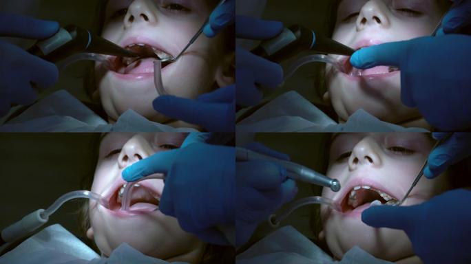 做牙科充填手术的孩子。