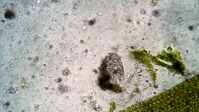 显微镜下微观世界中纤毛虫的重要活性