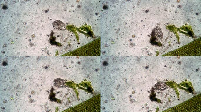 显微镜下微观世界中纤毛虫的重要活性