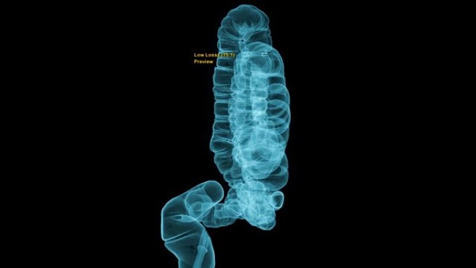 结肠三维渲染图像的CT结肠造影或ct扫描。