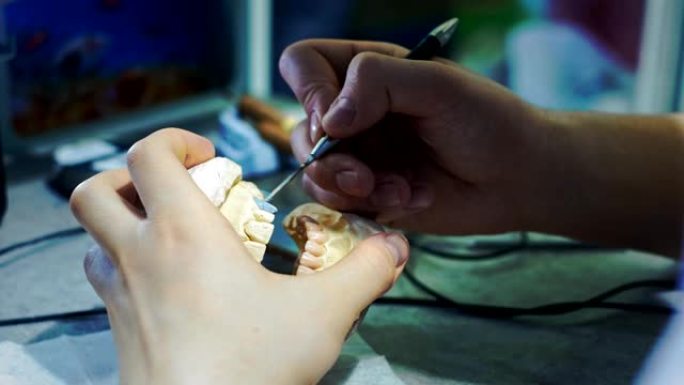 牙医医生在颌骨上做假牙。牙医手里拿着一个下颌植入物，用工具涂抹材料。牙科的现代技术。特写，全高清。