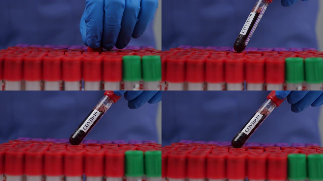 近距离研究人员在试管中保存血液以检查新型冠状病毒肺炎