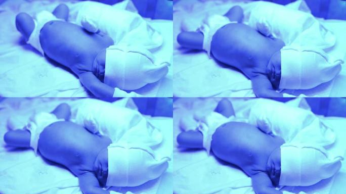 新生儿在家庭床上在紫外线灯下治疗黄疸