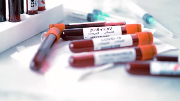 冠状病毒、Covid-19和2019新型冠状病毒几种血液试管
