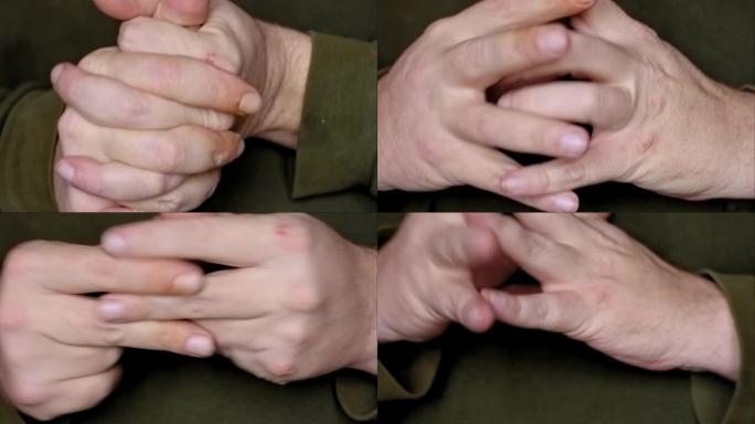 男性特写镜头弯曲学生塑料，用严重受损的皮肤摩擦双手，打手势