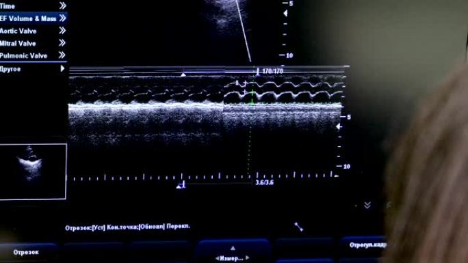 兽医对波斯猫进行超声波检查。4K