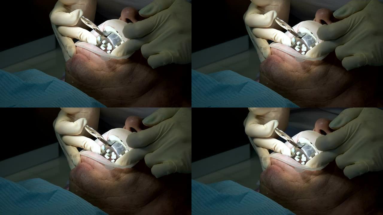 女牙医与助手一起检查患者的口腔。牙科诊所牙医的高级专业工作