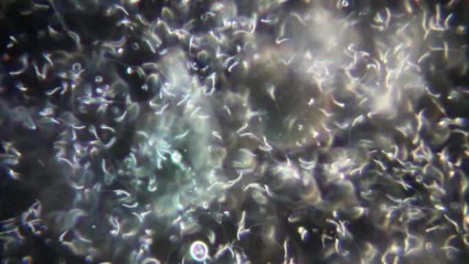 实验室显微镜下鸡精子的研究。