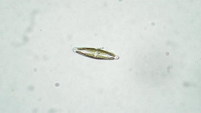 显微镜下白色背景上的一种硅藻藻cymbella