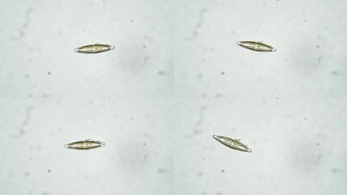 显微镜下白色背景上的一种硅藻藻cymbella