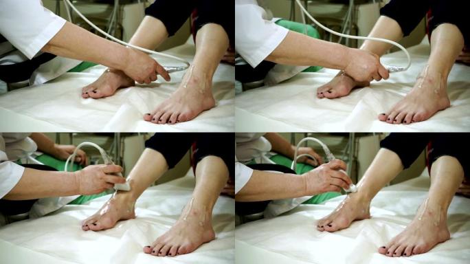 女医生用超声波扫描仪检查妇女的右脚。高清