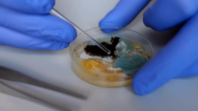 科学家分析细菌培养。特写。化学实验室细菌培养皿。用蓝色手套握住带有霉菌和细菌菌落的培养皿。科学专业嫁
