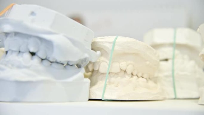 人类牙颌石膏模型铸造。实验室假肢。特写