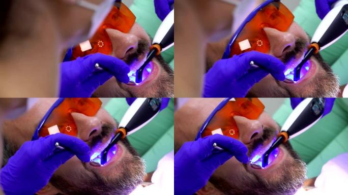 牙医正在使用uv灯进行牙齿修复的牙科程序