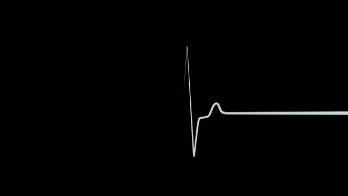 医疗屏幕上的EKG或ECG flatline