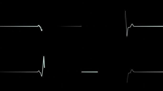 医疗屏幕上的EKG或ECG flatline