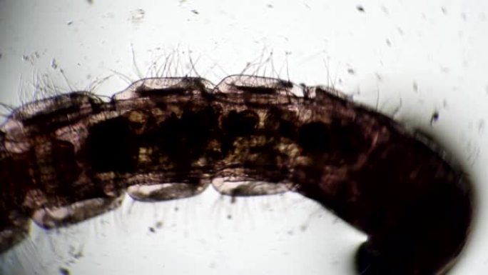 不安分的蠕虫在显微镜中移动