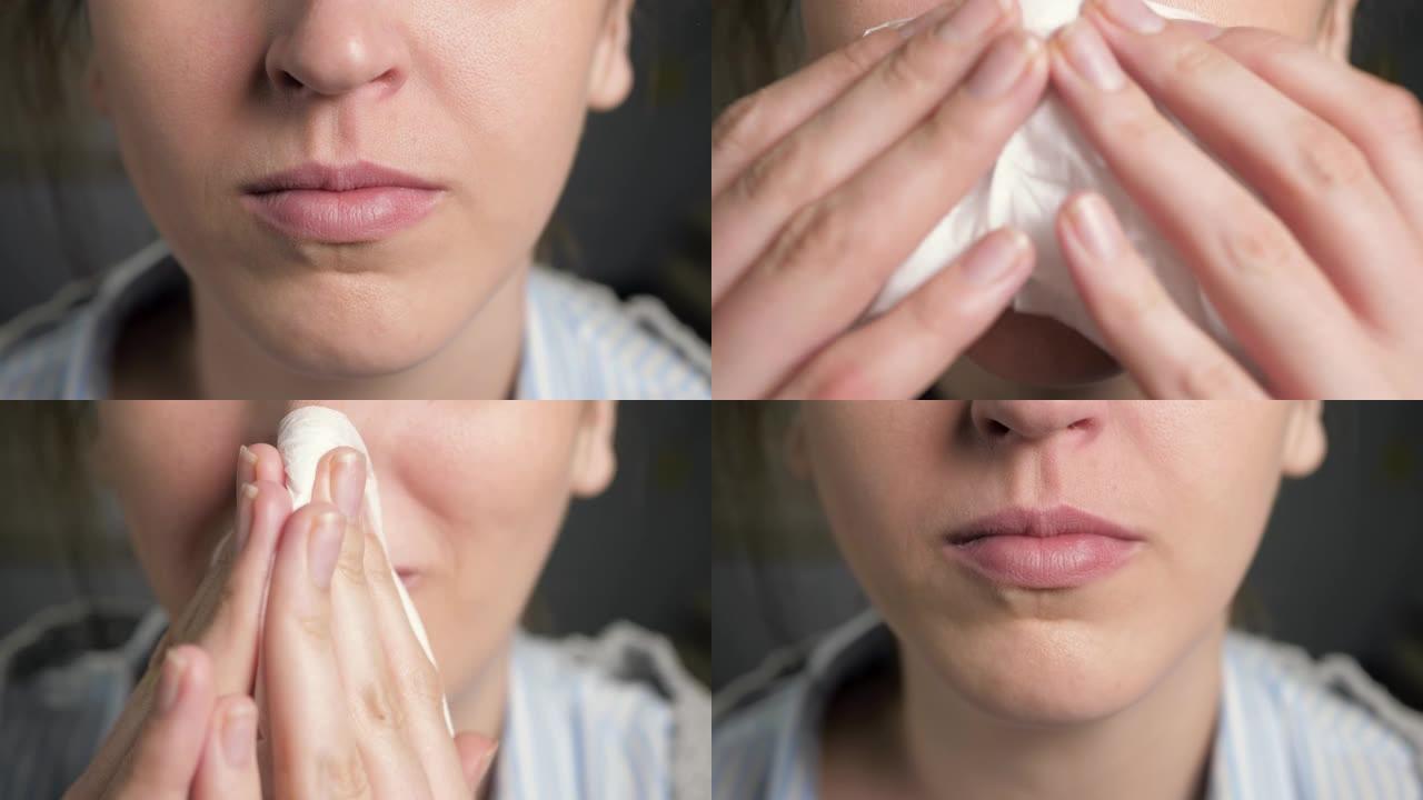 女人用纸巾擦鼻子。流鼻涕，感冒，流感，过敏，灰尘，猫毛，鼻炎，体温过低，空气干燥的概念。前视图。特写