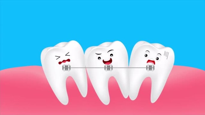 可爱的卡通牙套。牙科保健概念，动画。