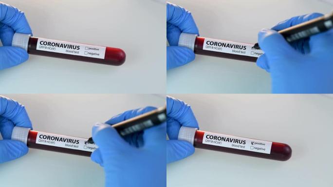 冠状病毒特写展示血管血液