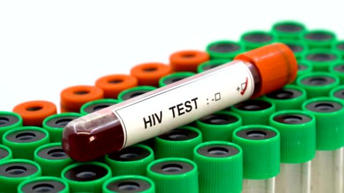 HIV病毒检测