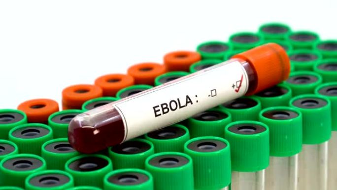 埃博拉病毒阳性埃博拉病毒阳性