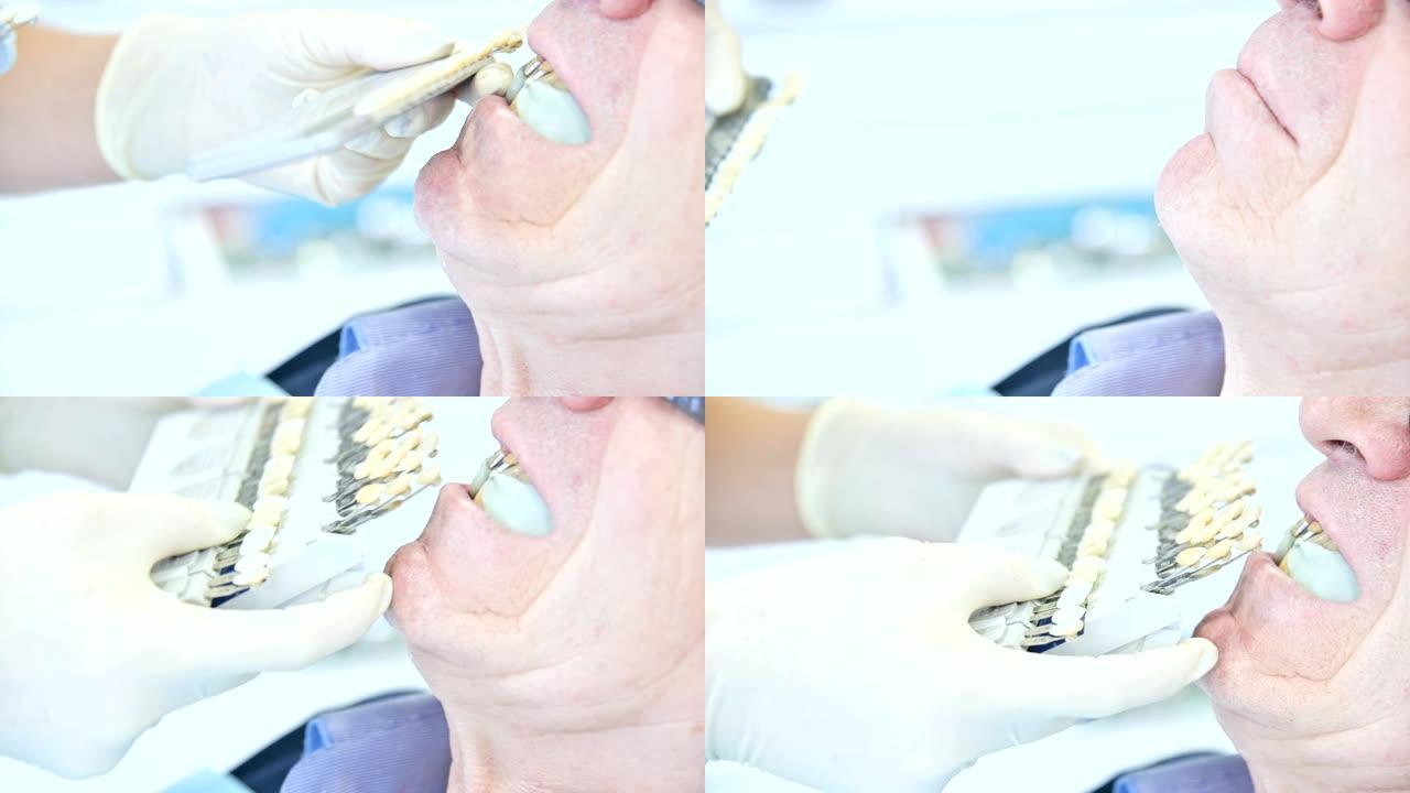 特写口腔科医生为患者选择一种颜色来创建假体。4k牙科
