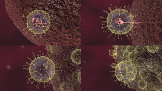 新型冠状病毒肺炎攻击细胞