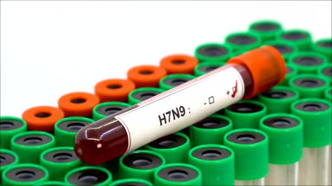 H7N9流感病毒阳性