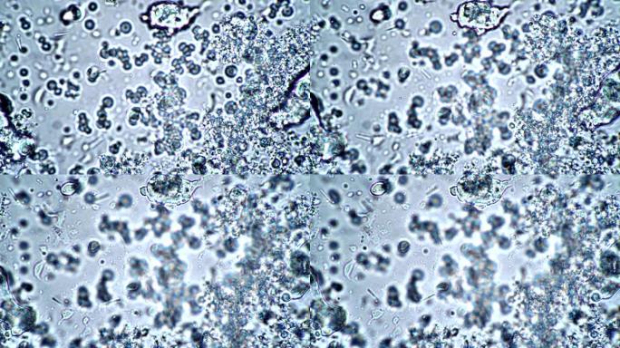 显微镜下来自棒和杆菌的乳酸发酵