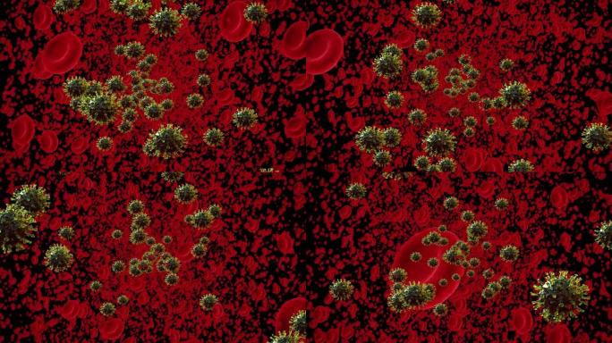 受covid19冠状病毒，α 通道污染的细胞的血流