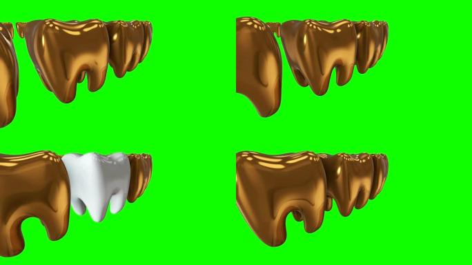 一排金牙中的白牙。3D渲染。牙科，出众，经营理念。