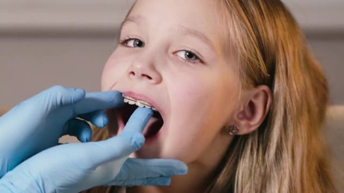 正畸医生在女孩的牙齿上放置一个特殊的板以使其对齐，从而在儿童时期矫正牙齿